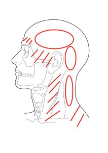 偏頭痛や不眠症治療のマッサージポイント